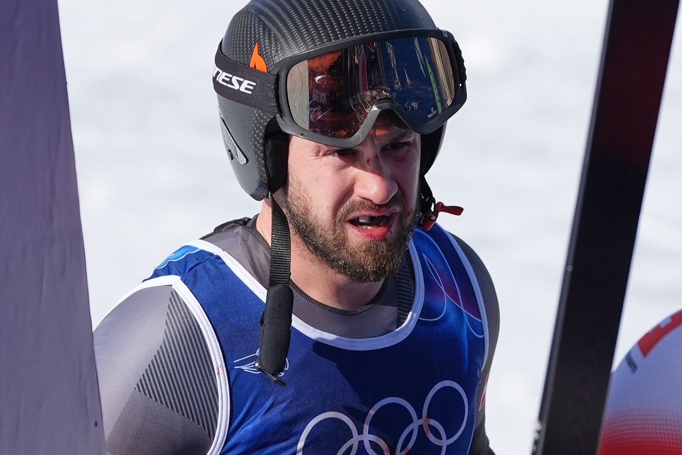 Милан-2026: Австриялық спортшы жаттығу кезінде құлап, бетін жарған